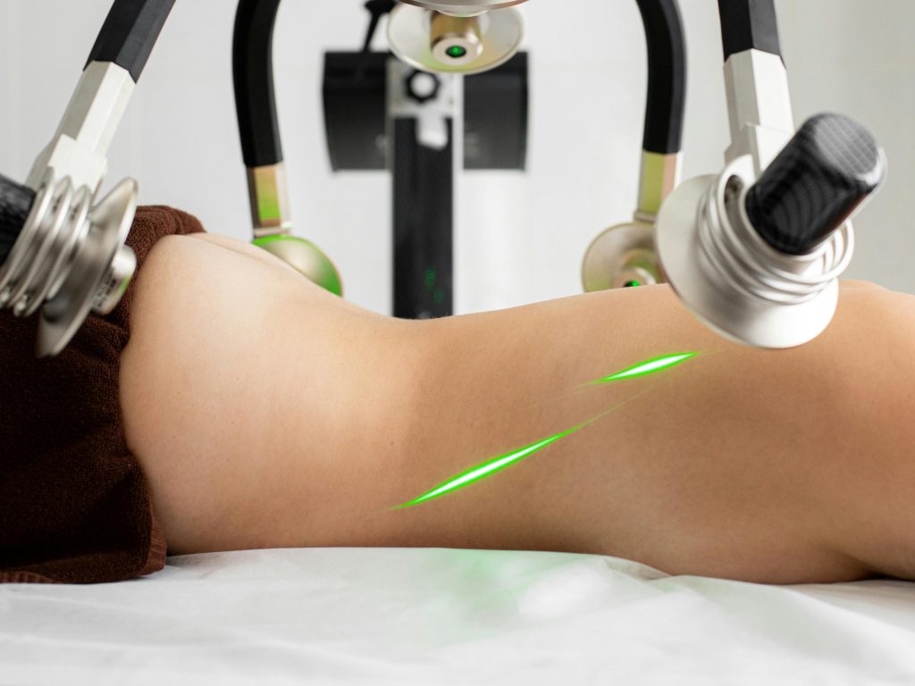 lipo laser og lipo laser virker det